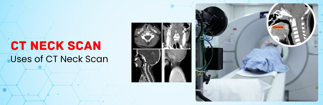 What are the Uses of CT Neck Scan